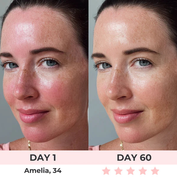 LED Photon Rejuvenation Face Mask